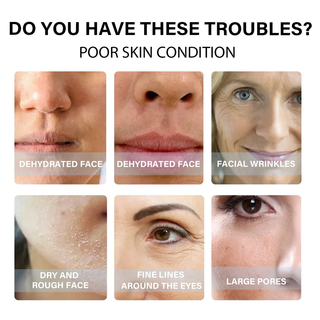 EELHOE Protein Threads Face Lift Skin Tightening Rejuvenate the Face Nourishing Deep Repair Skin Firming Protein Line Collagen
