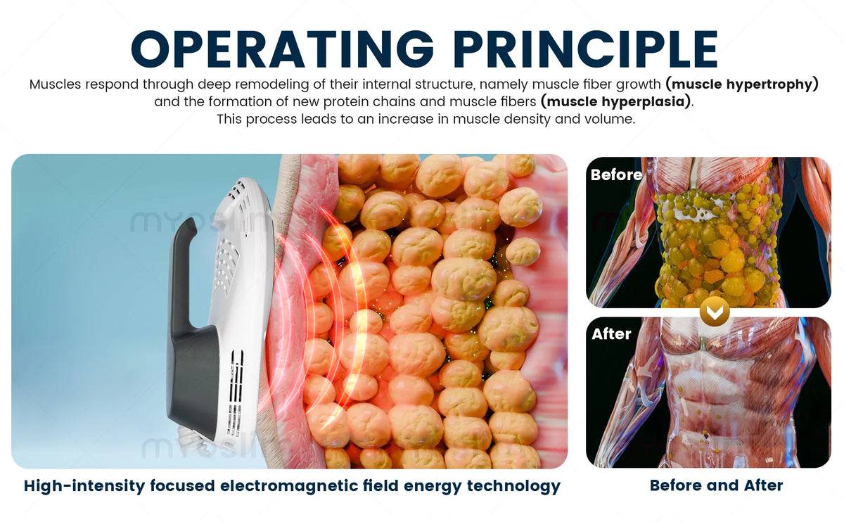 MYOslim EMS Body Slimming Machine 6500W Portable Electromagnetic Muscle Stimulator for Fat Removal And Weight Loss Sculpting