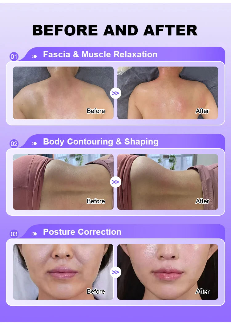 Upgrade 448KHZ RF Tecar Therapy RET CET Diathermy Fat Removal Machine Anti-Cellulite Relieve Pain Home Appliance Muscle Massager