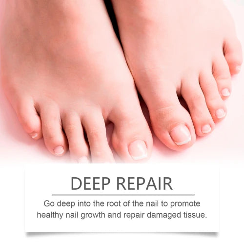 South Moon Repair Solution Soft Thick Nails Cleaning Nourishing Care Around The Nail