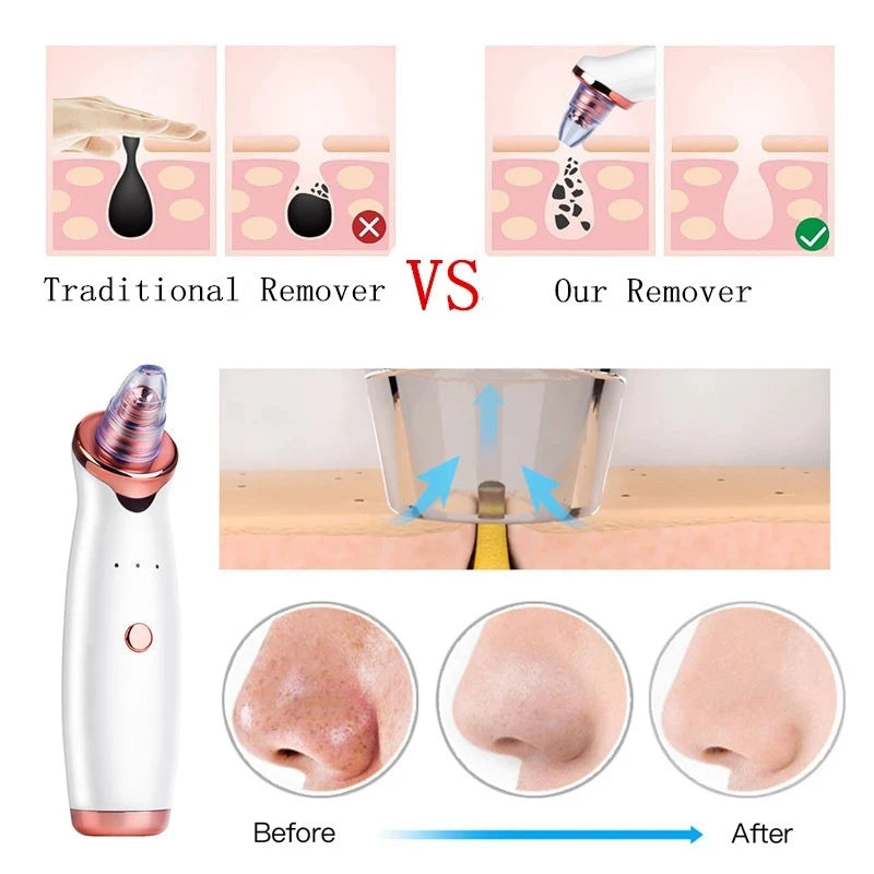 Gadgets 2025 Electric Blackhead Removal Instrument Black Spots Removal Facial Deep Cleansing Pore Cleaner  Skin Care Tools