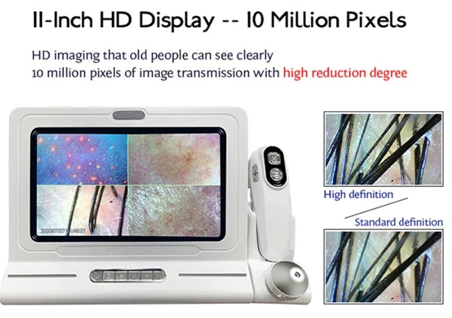 High Quality Handheld HD 3D Portable Scalp & Face & Body Skin Analyzer Machine with US Plug for Commercial Use