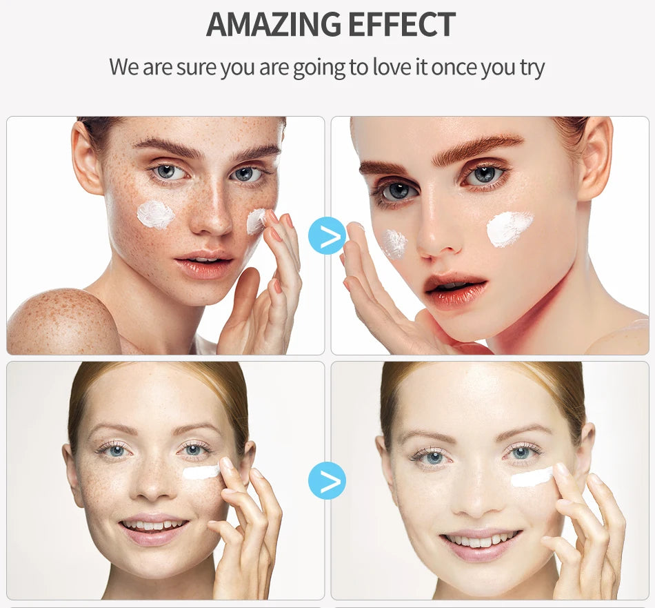 Dimollaure Whitening Freckle Cream Moisturize Firming Anti-Wrinkle Remove Dark Spots Melasma Melanin Bright Face Korea Skin Care