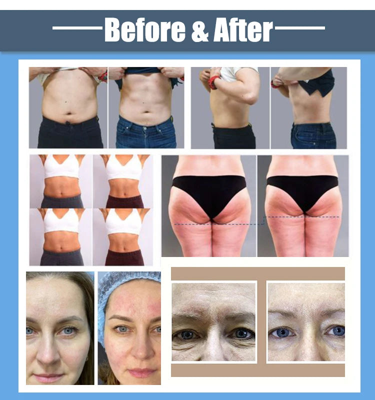 Portable 360 Aesthetic Sculpting Machine Fat Loss Body Slimming Face Tightening Shaping Device