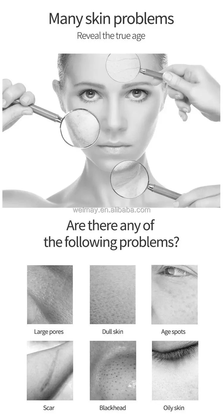 Factory OEM ODM Oxigen Facial Machine Jet Peel Moisturizer Pore Cleaner Skin Rejuvenation Hydradermabrasion Oxygen Portable