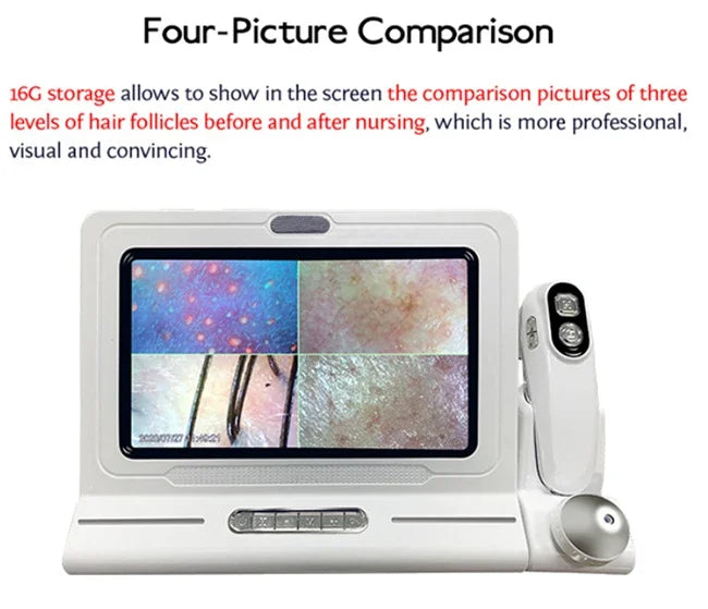 High Quality Handheld HD 3D Portable Scalp & Face & Body Skin Analyzer Machine with US Plug for Commercial Use
