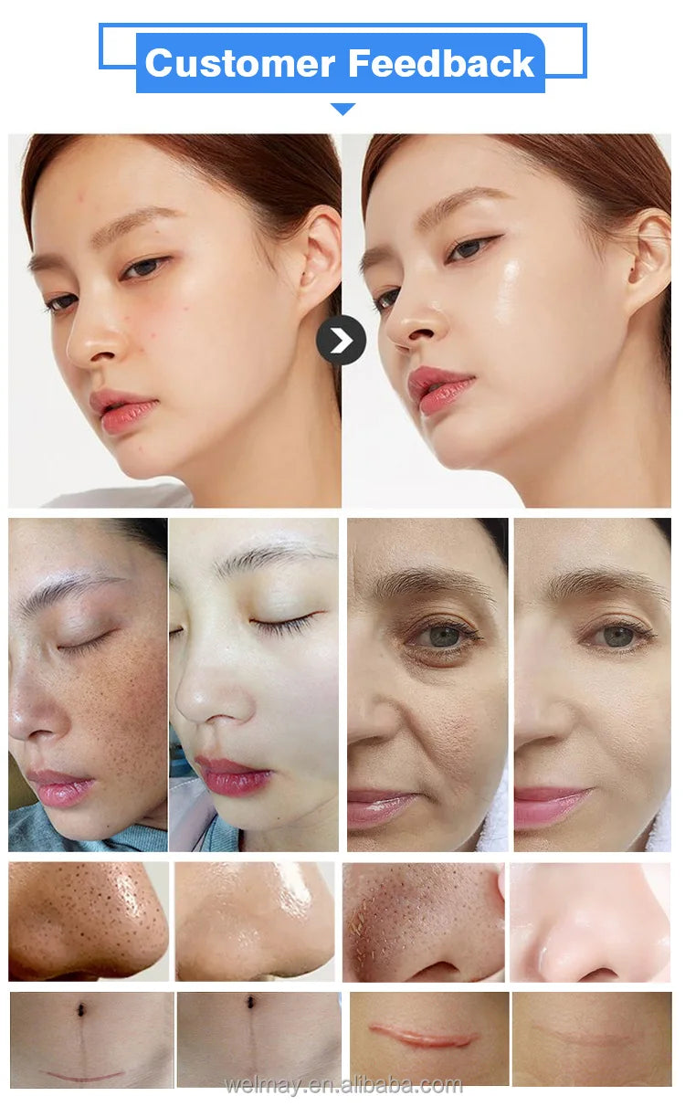 Factory OEM ODM Oxigen Facial Machine Jet Peel Moisturizer Pore Cleaner Skin Rejuvenation Hydradermabrasion Oxygen Portable