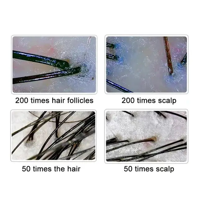 10 Inch LCD Scalp Detector Hair Skin Analyzer Microscope for Hair Follicle Testing and Skin Analysis Magnifier 50/200X