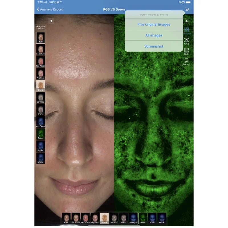 2024 AI Magic Mirror Facial Skin Analyzer Targeting Face Model MC88 with Plug Compatibility-IT JP US ZA
