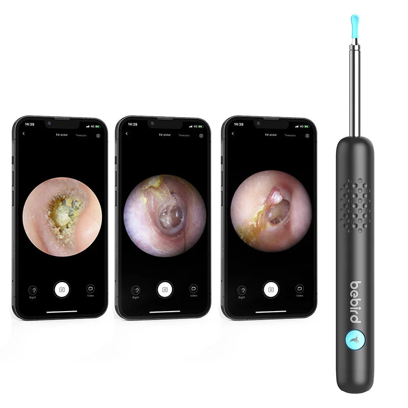 For R1 Hot Visual Ear Endoscope Ear Cleaner with HD 1920x1080P 30fps 3-Axis Gyroscope Camera-Product Entry Into CVS Pharmacy