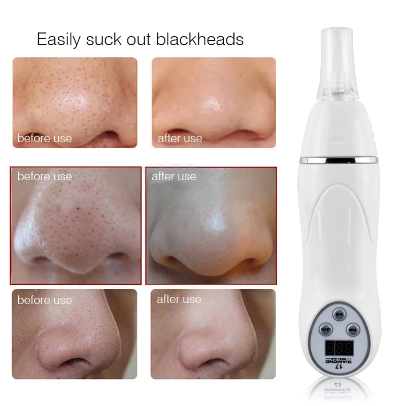 Digital Diamond Blackhead Removal Microdermabrasion Machine Suction Skin Pore Clean Facial Massage Peeling Acne Beauty Device