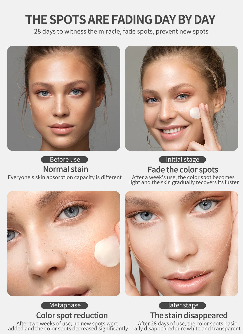 Dimollaure Whitening Freckle Cream Moisturize Firming Anti-Wrinkle Remove Dark Spots Melasma Melanin Bright Face Korea Skin Care