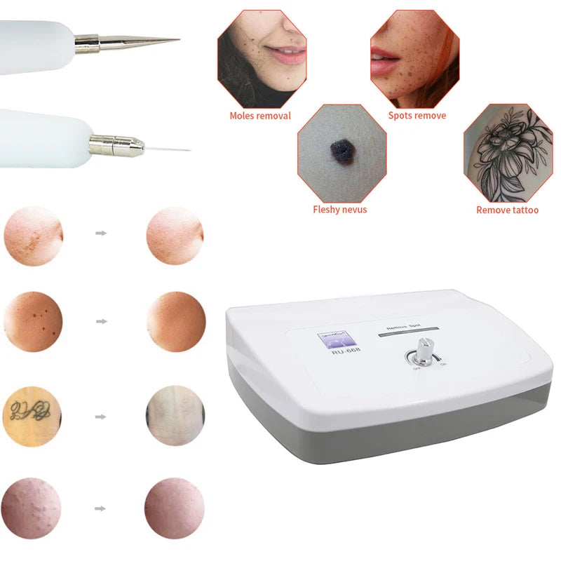 Auro Spot Remover Facial Warts Remover Skin Tag and Mole Removal Machine Electro Cautery Pen