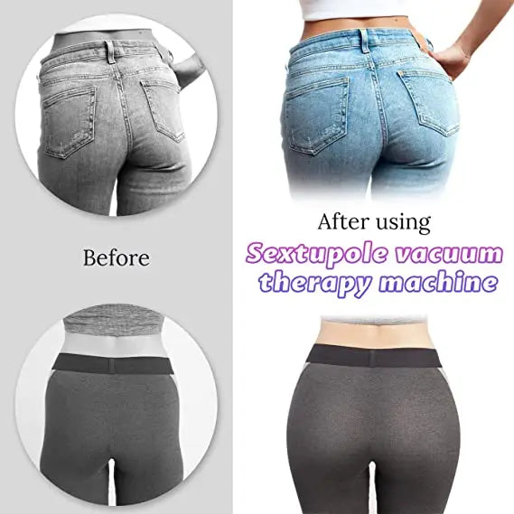 USA Stock Vacuum Buttocks Lifting Enlargement Butt Suction Butt Lift Cup Vacuum Therapy Machine