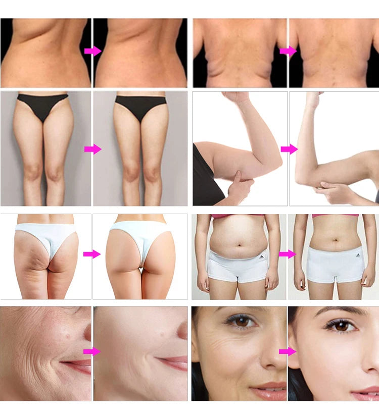 OEM/ODM Quick Slim 30k s Body Shape Cavitations Slimming Machine 30k Vacuum Rf Skin Tightening & Fat Loss Machine 5 in 1