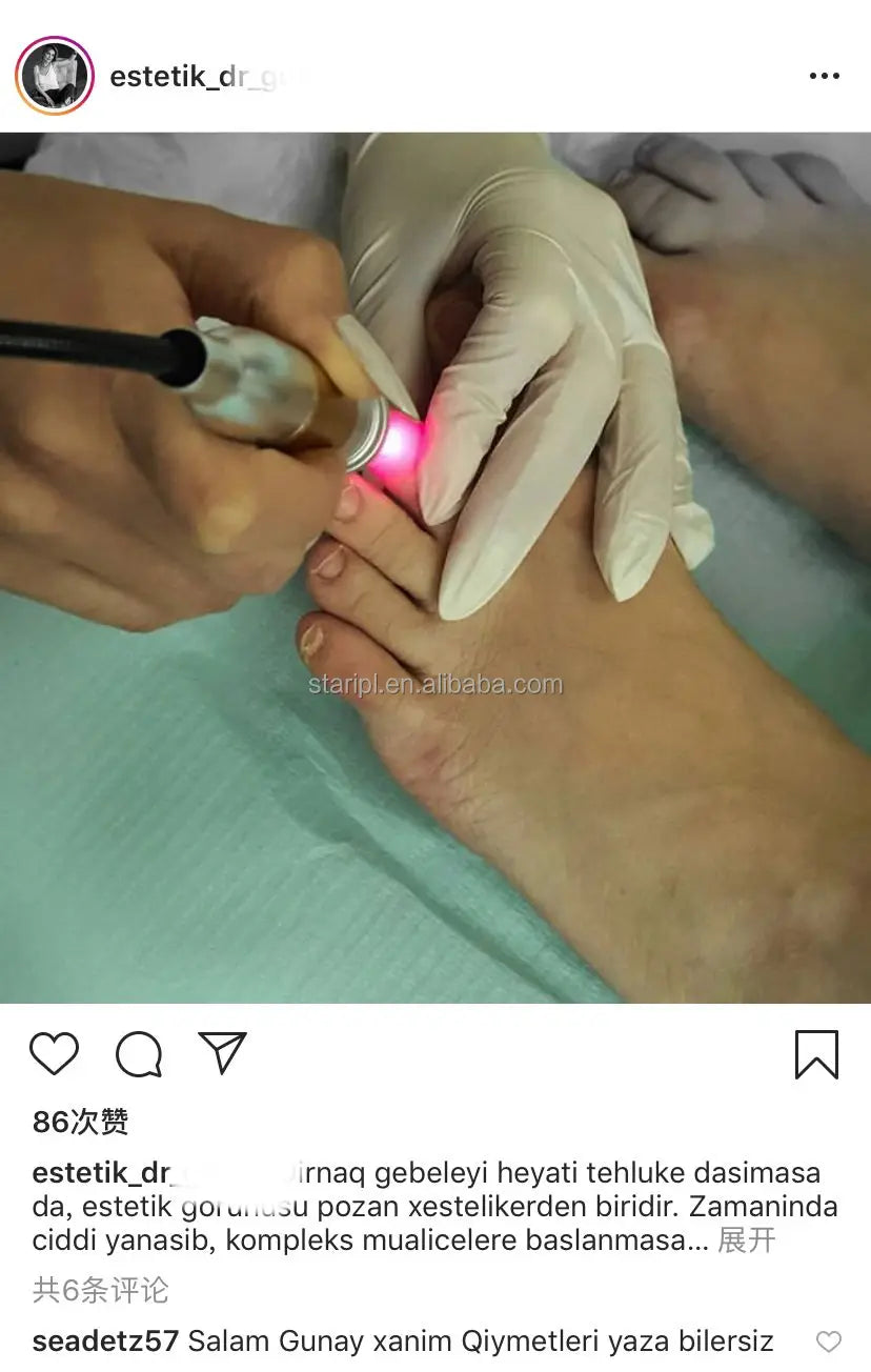 Pinpointe Nail Laser Diode 40W Dual Wave 980nm 1470nm Anti Fungus Toenails Podologia Onychomycosis Podiatry Foot Wart Machine