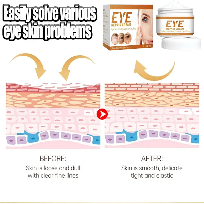 Deep Eyes. Deep Moisturizingᑫᵘⁱᶜᵏˡʸ ʳᵉᵐᵒᵛᵉˢ ᵉʸᵉ ᵇᵃᵍˢ ᵃⁿᵈ ᵖʳᵒᵗᵉᶜᵗˢ ᵗʰᵉ ᵉʸᵉ ᵃʳᵉᵃ