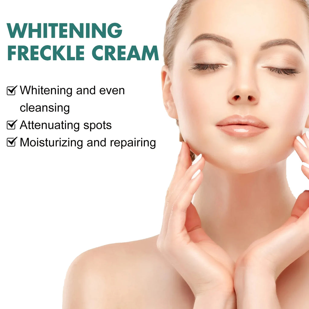 EELHOE Niacinamide Cream Chloasma Melanin Removal Melasma Lightener Smooth Skin Brightening Vitamin C Arbutin Freckle Cream 30g