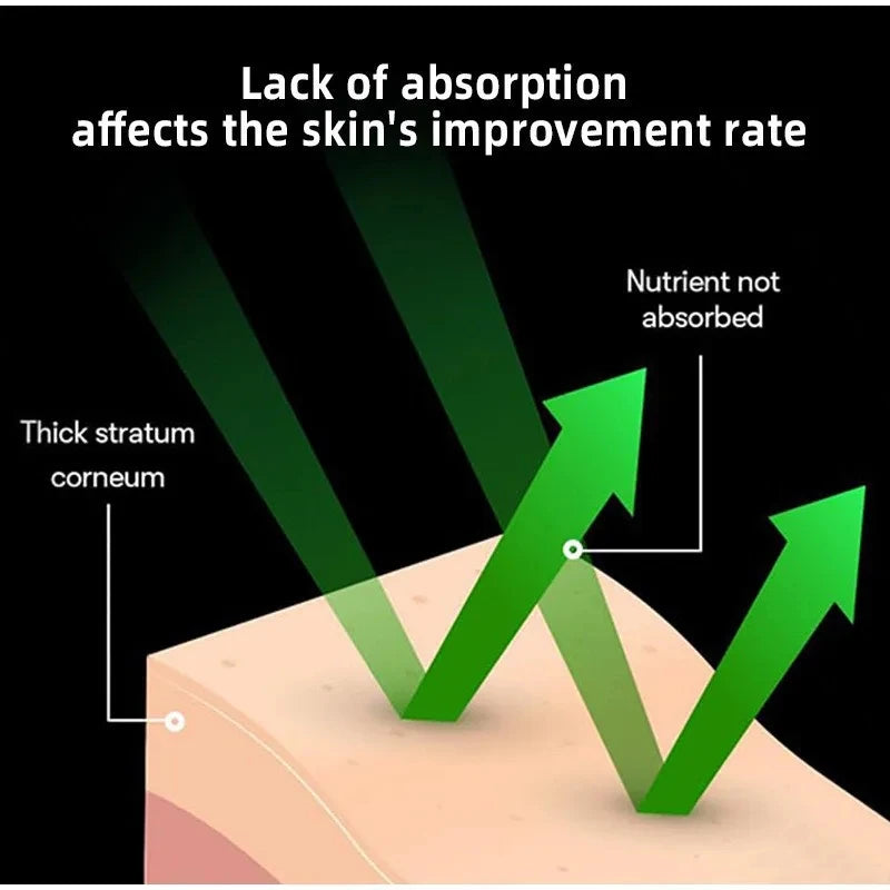 Korean Microneedle Essence Desalination Fine Lines Spots Collagen Solution Reverse Aging Recombinant Improves Rough Texture 50ml