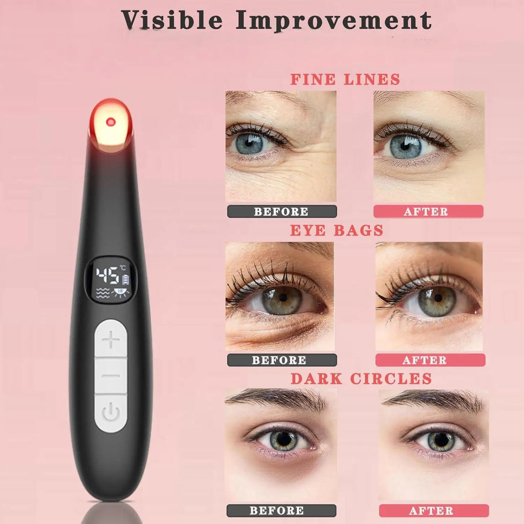Eye Beauty Device 3 in 1 Eye Massager Wand with Red LED Light Vibration Massage Portable Beauty Machine Electric Eye Care Tool