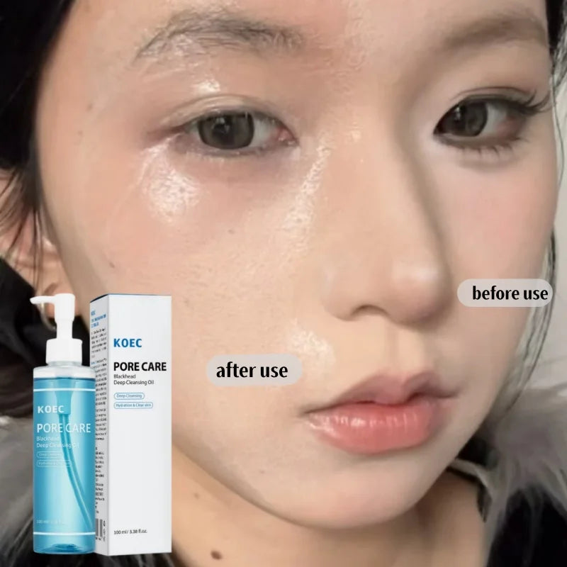 Pdrn Jelly Cleanser Gentle Non-irritating Foam Cleansing Deep Cleanse Amino Acid Soothing Moisturizing Cleansing Korean Skincare