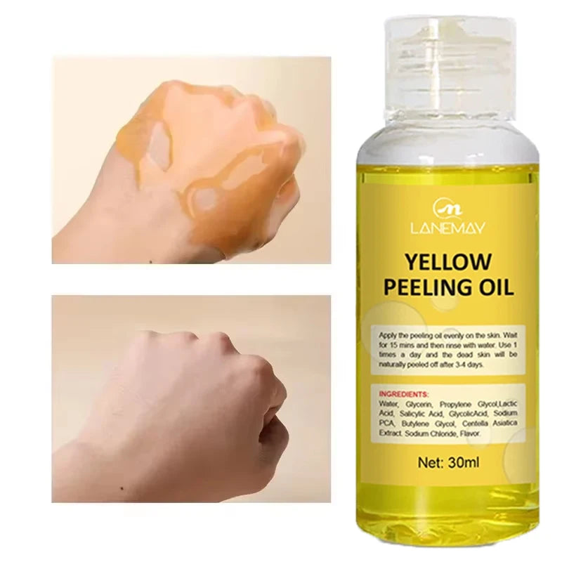 Yellow Peeling Oil Body Cleansing Exfoliation For Tender Glowing Skin Finger Joint Whitening Moisturizing Care Beauty Products