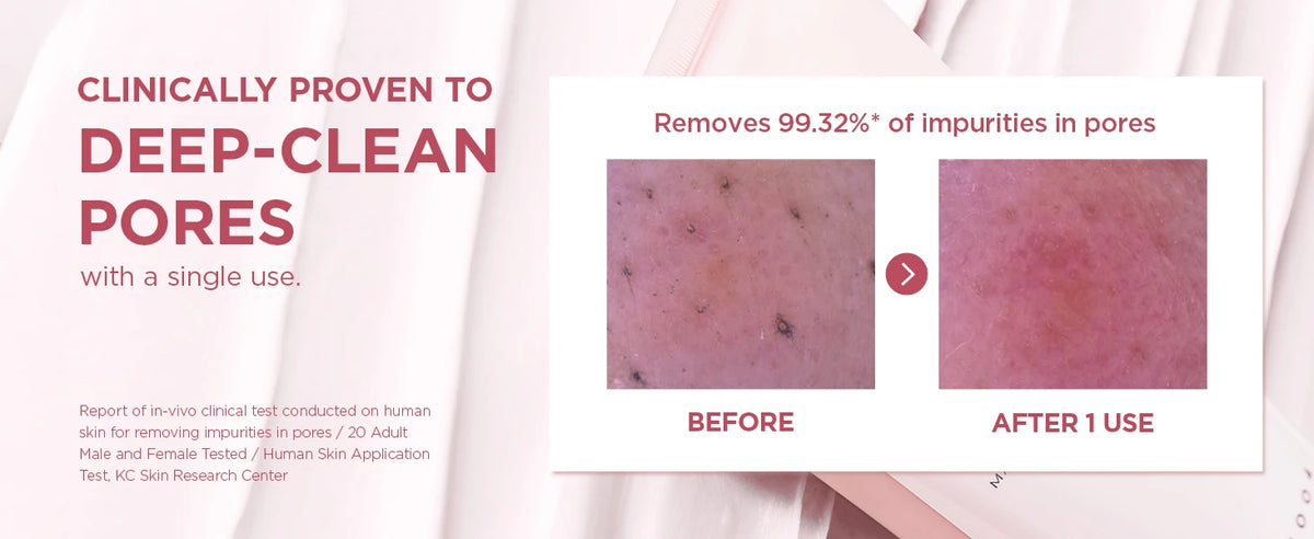 SKIN1004 Poremizing Deep Cleansing Foam Korean Face Cleanser Pink Salt Gentle Exfoliate Soothing Centella Asiatica Face Cleanser