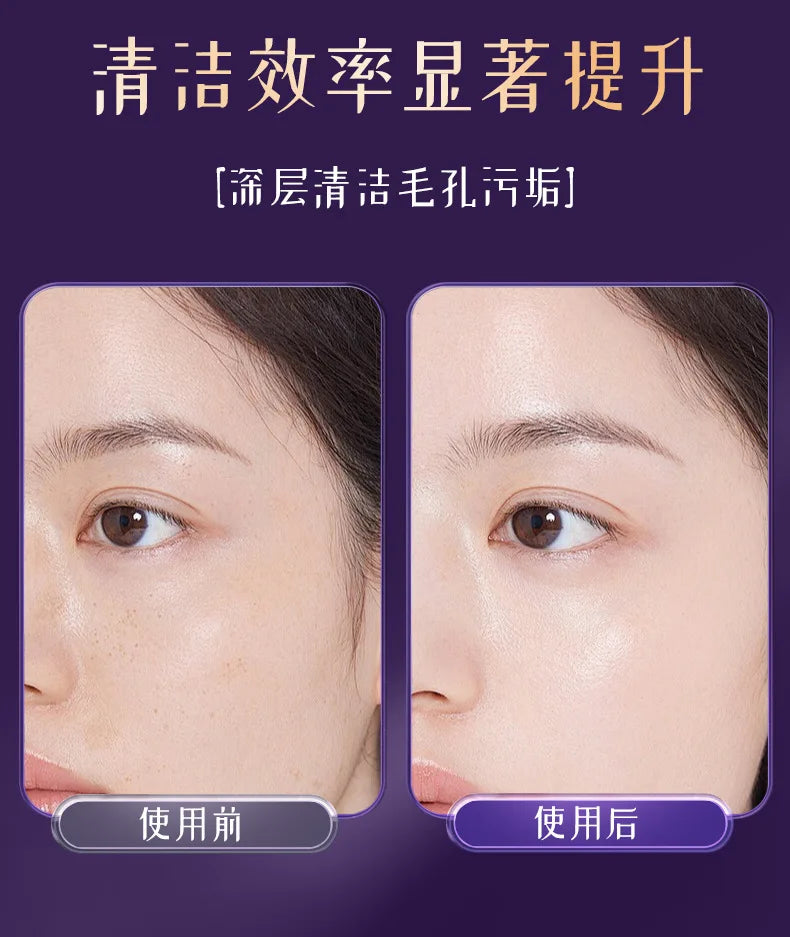 Beauty Device Facial Massage And Cleansing Devices Micro-Current Lifting Facial Massager