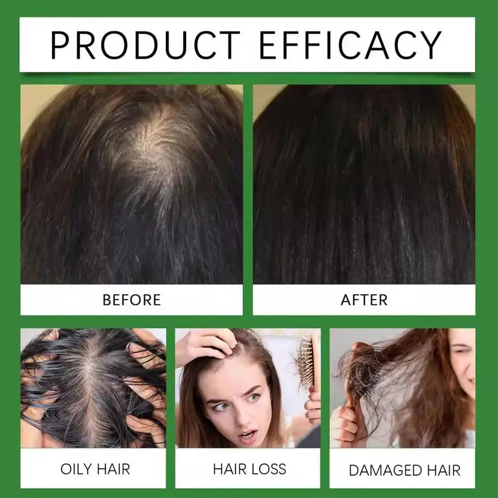 Rosemary Rice Water Hair Growth Spray with Peppermint Biotin Advanced Scalp Treatment for Thinning Hair Regrowth for Men & Women