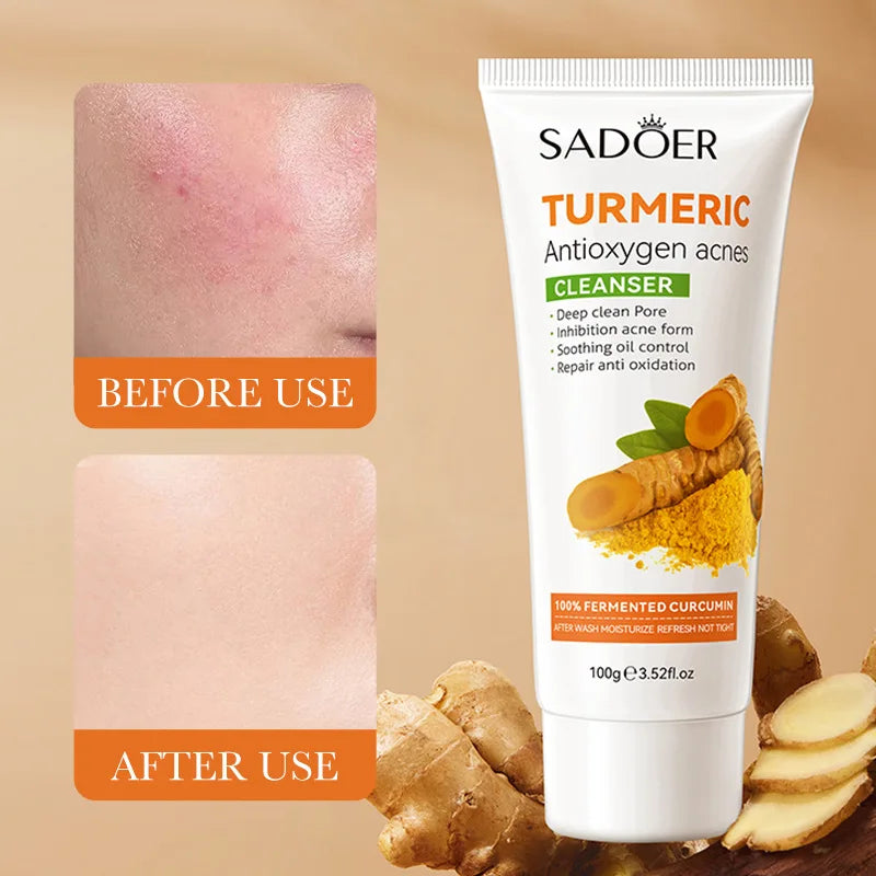 Turmeric Facial Cleanser: Antioxidant, Acne-Removing, Pore-Cleansing, Blackhead-Reducing, Oily Skin-Controlling, And Repairing.
