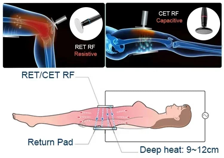 2026 new CET RET Thermal System Indiba Tecar Intelligent Diathermy Machine Physiotherapy 448khz ER45 Body Shaper
