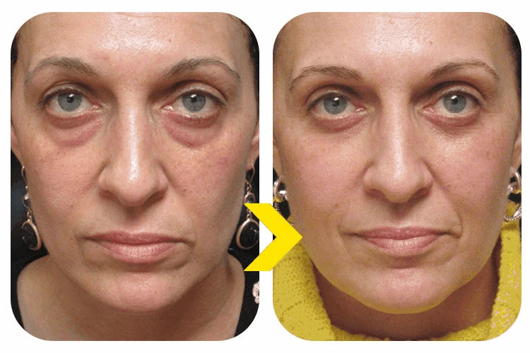 2026 New Upgraded Bestselling Eye Care Tool - Eye Revitalizing Ointment (Free Shipping)