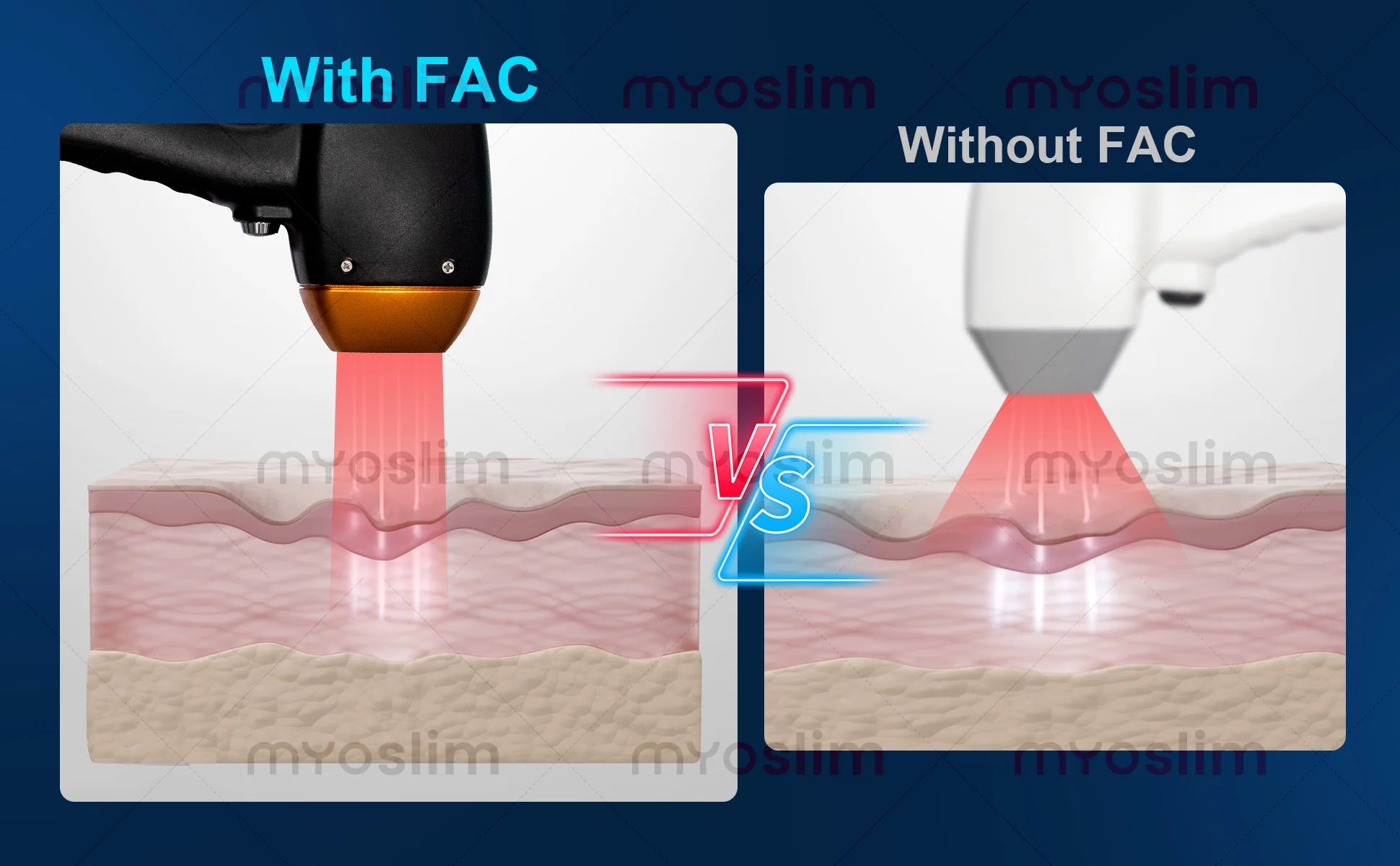 Myoslim 2In1 FAC 10Bars Diode 808 Lase Hair Removal Machin Picosecond Tattoo Removal Machine 4Wavelength Skin Rejuvenation