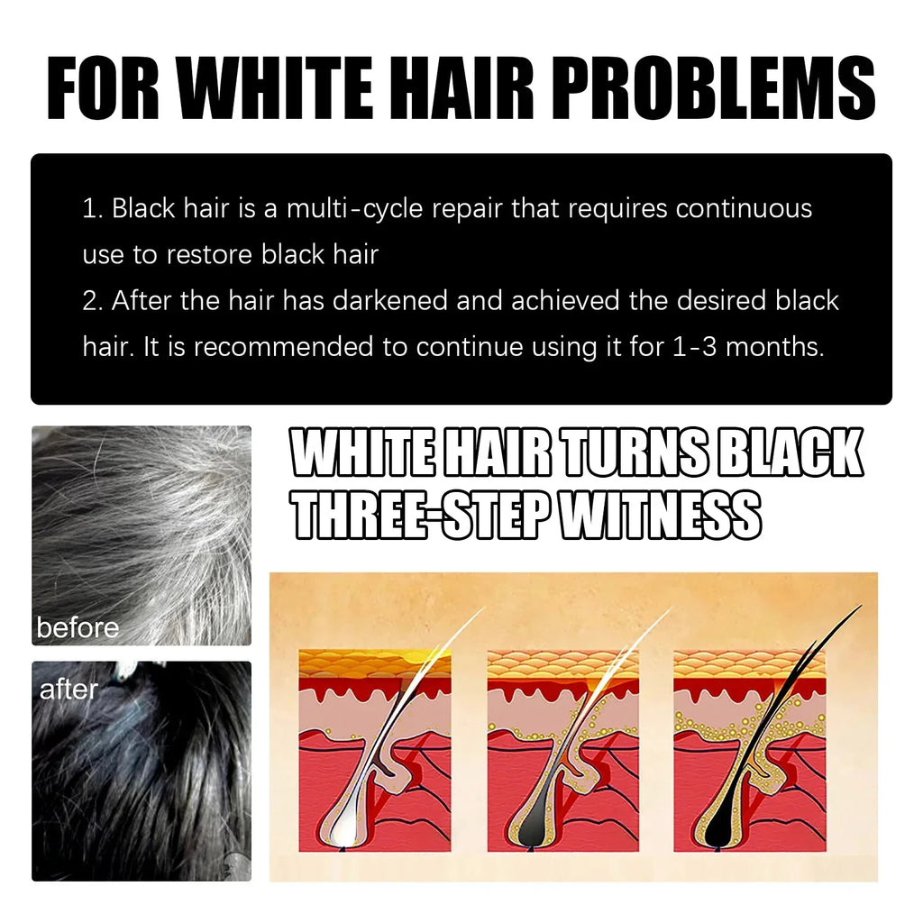 Herbal Anti-grey Hair Treatment Serum Cream White To Black Permanent Repair Natural Color Nourish Scalp Hair Care Products