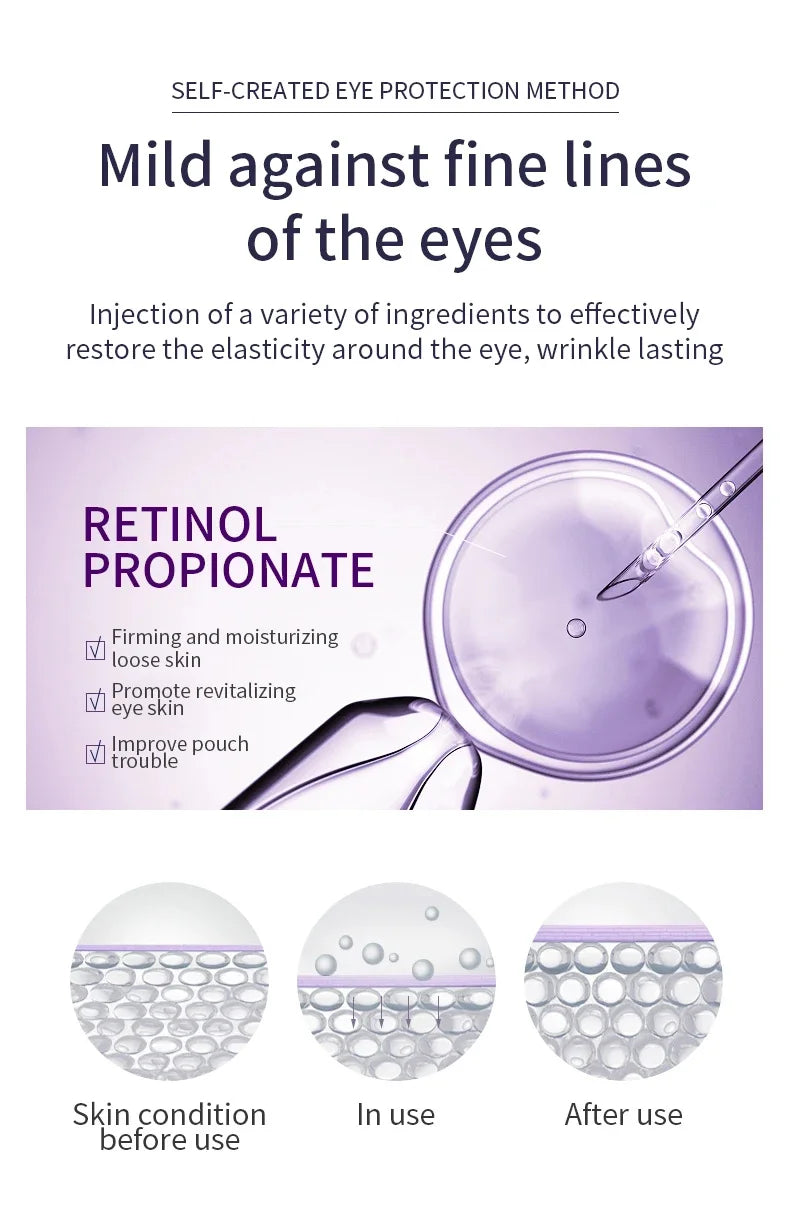 Anti Wrinkle Anti Dark Circle Eye Cream Roller Massager Moisturizing Eye Bags  Retinol Anti Aging Eye SkinCare Products O'CHEAL