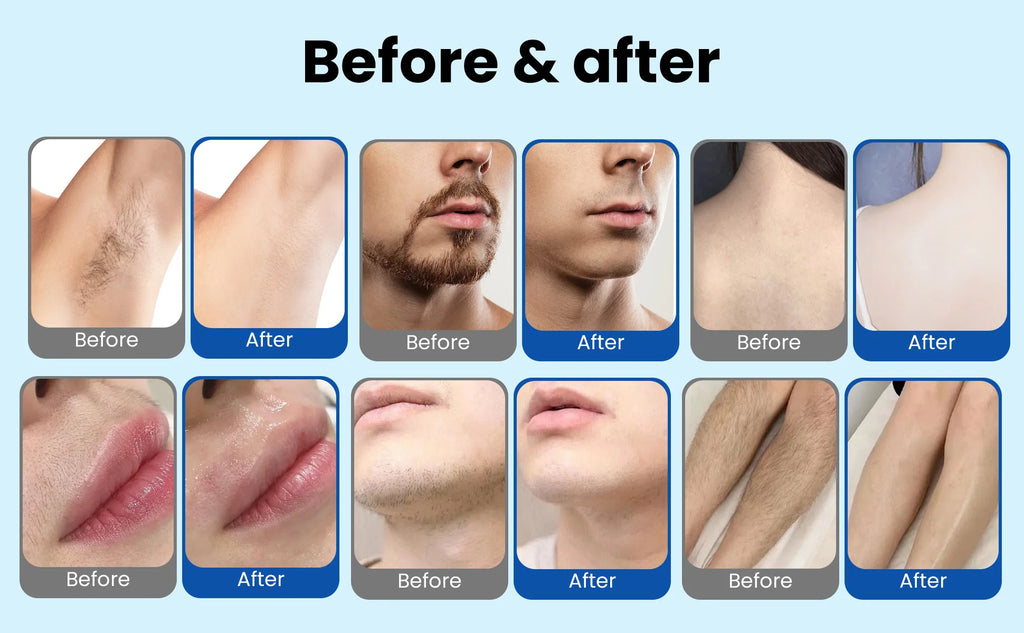 Professional 808nm diode hair removal machinePermanent Hair Removal equipment, Private and Painless Full body Hair Removal