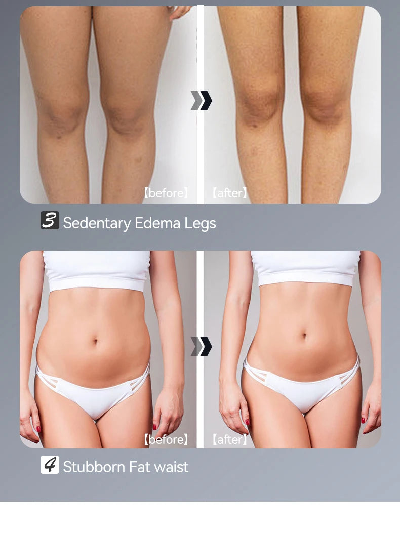 EMS & RF Body Slimming Device Cellulite Remover Pulse Fat Burner Body Shaping Lose Weight Machine for Belly Waist Arm Leg Butt