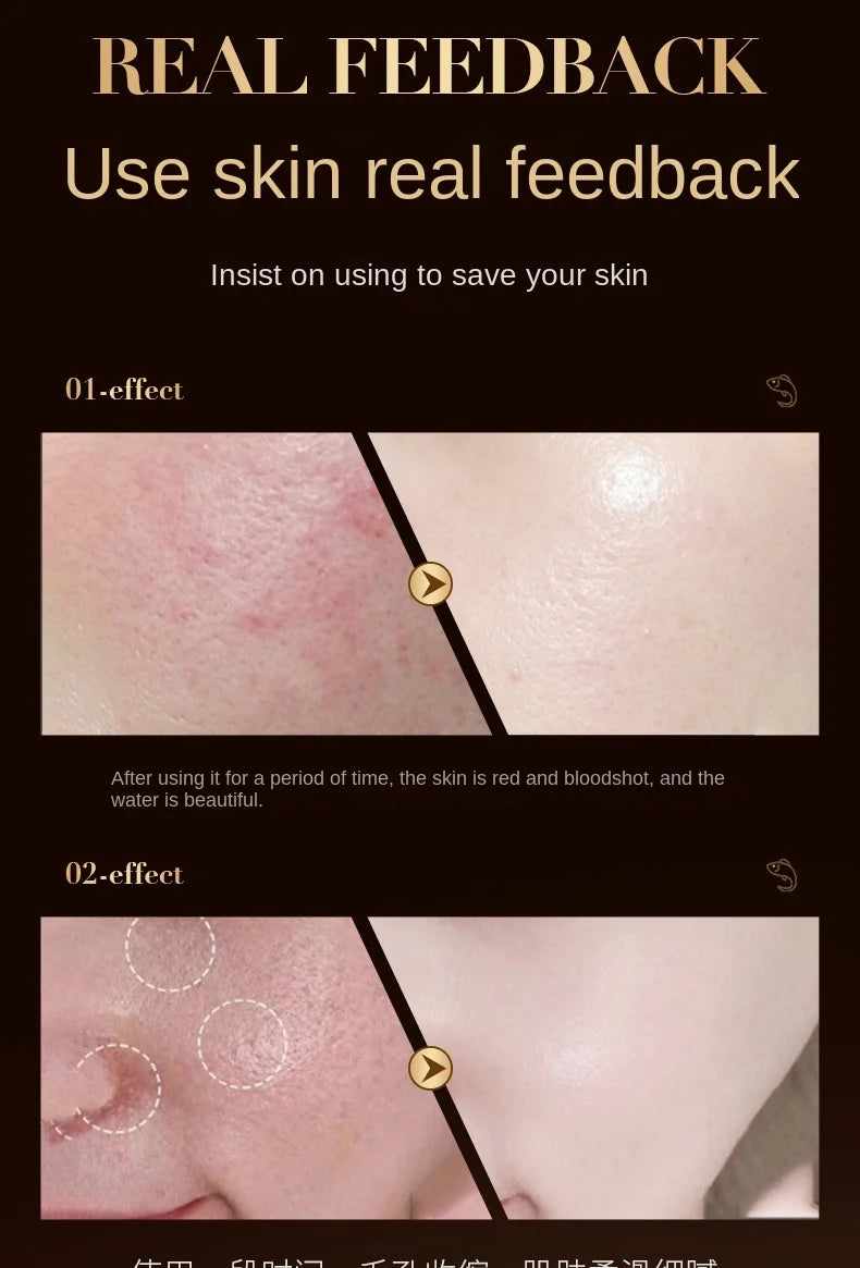 Caviar Wrinkle Anti-Aging Fade Fine Lines Face Whitening Bright Skin Beauty Health Care Retinol Lifting Firming Cream New