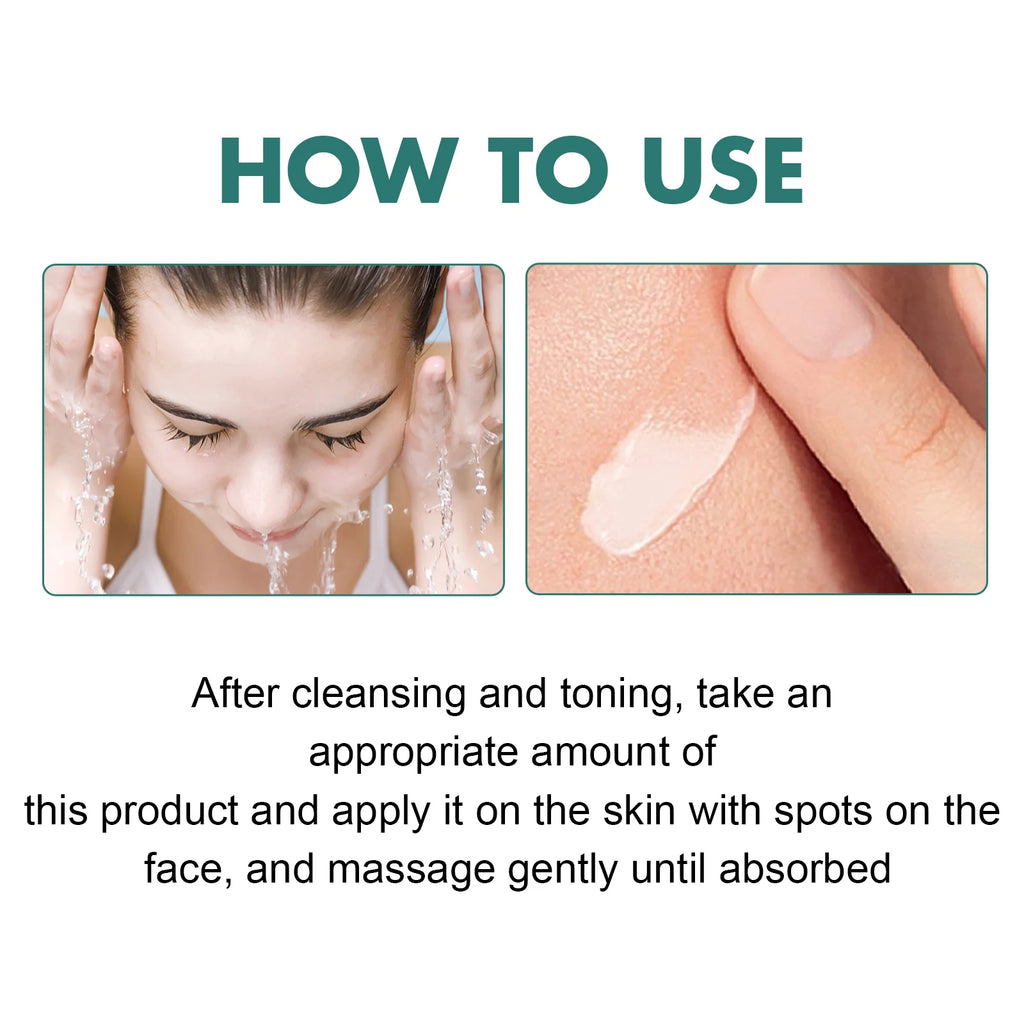 EELHOE Niacinamide Cream Chloasma Melanin Removal Melasma Lightener Smooth Skin Brightening Vitamin C Arbutin Freckle Cream 30g