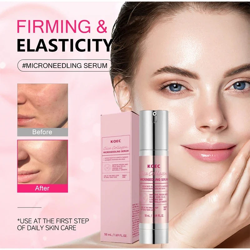 Korean Collagen Microneedle Serum Hydrating Soothing Brighten Facial Essence Dragon Blood Centella Asiatica Repair Skin Serum