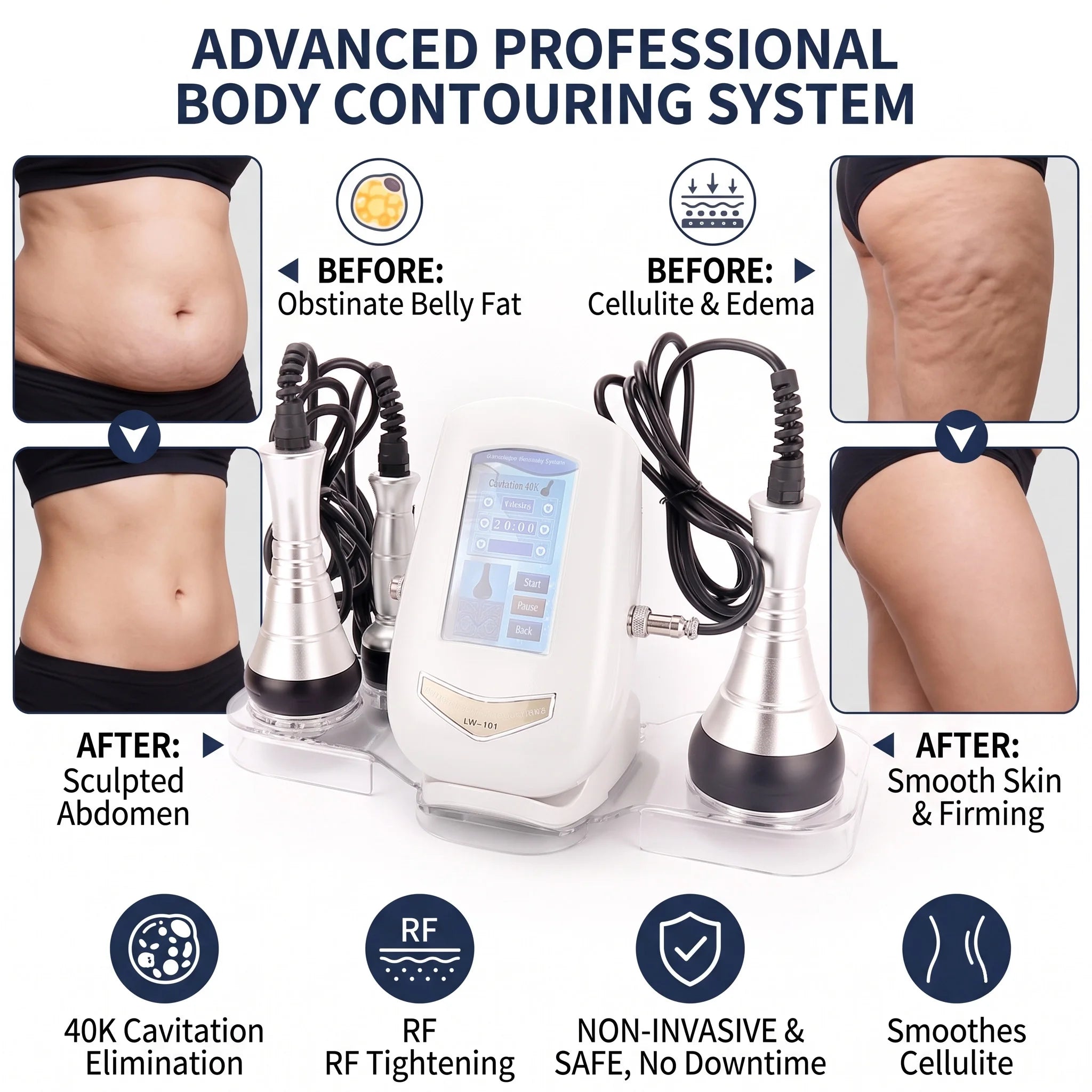 40K Ultrasonic Cavitation Slimming Machine Body Fat Burner RF Skin Lifting Beauty Device Anti Aging Belly Waist Weight Loss 110V