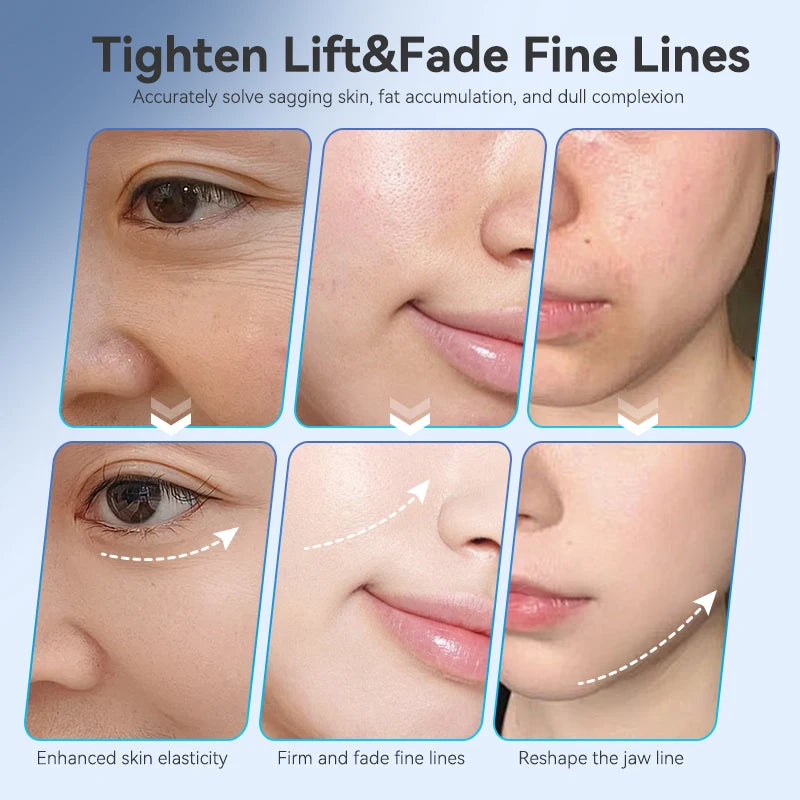 7 Types of Light Effect Facial Lifting Massagers, a Facial Shaping Tool with 3-Level Suction Strength Adjustment Function