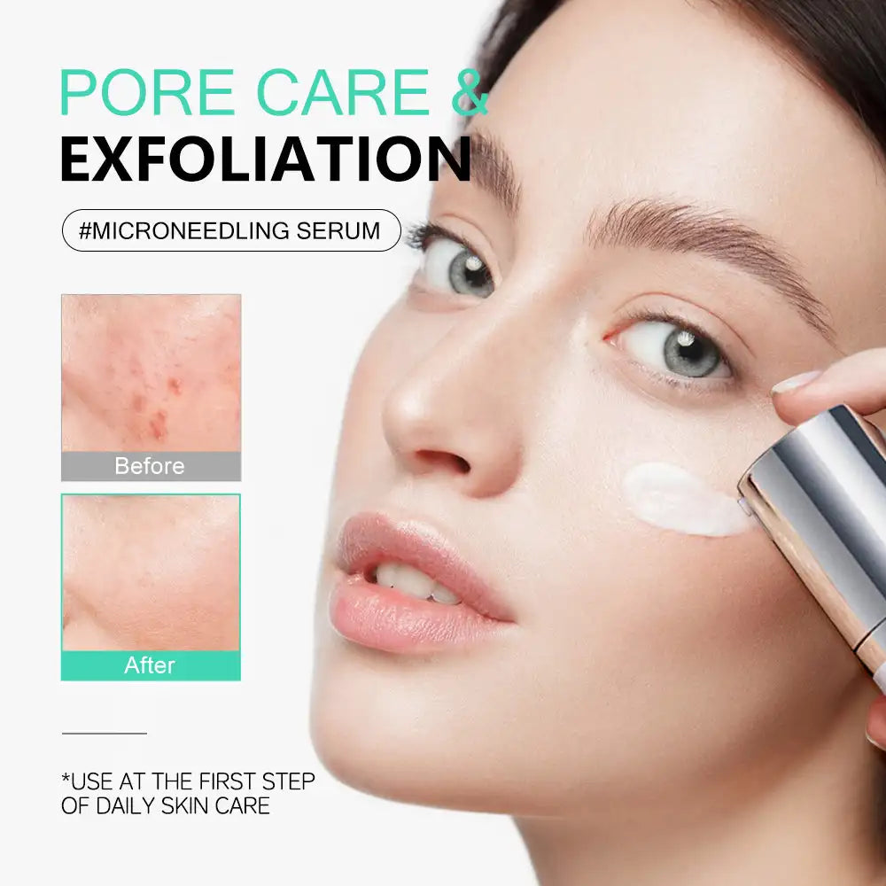 50ml KOEC PDRN Centella Microneedling Serum Moisturizing Brightening Smoothing Firming RefRefining Texture Glutathione Skin Care