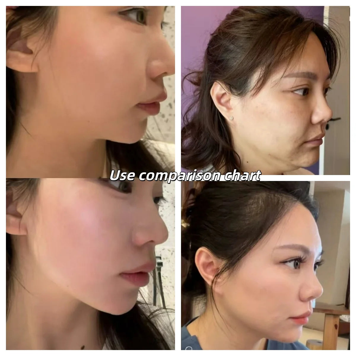 MYOslim EMS RF Electromagnetic Muscle Building Skin Firming Device Non-Invasive Face Lifting Wrinkle Removal Beauty Machine