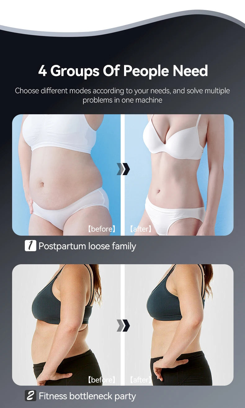 EMS & RF Body Slimming Device Cellulite Remover Pulse Fat Burner Body Shaping Lose Weight Machine for Belly Waist Arm Leg Butt