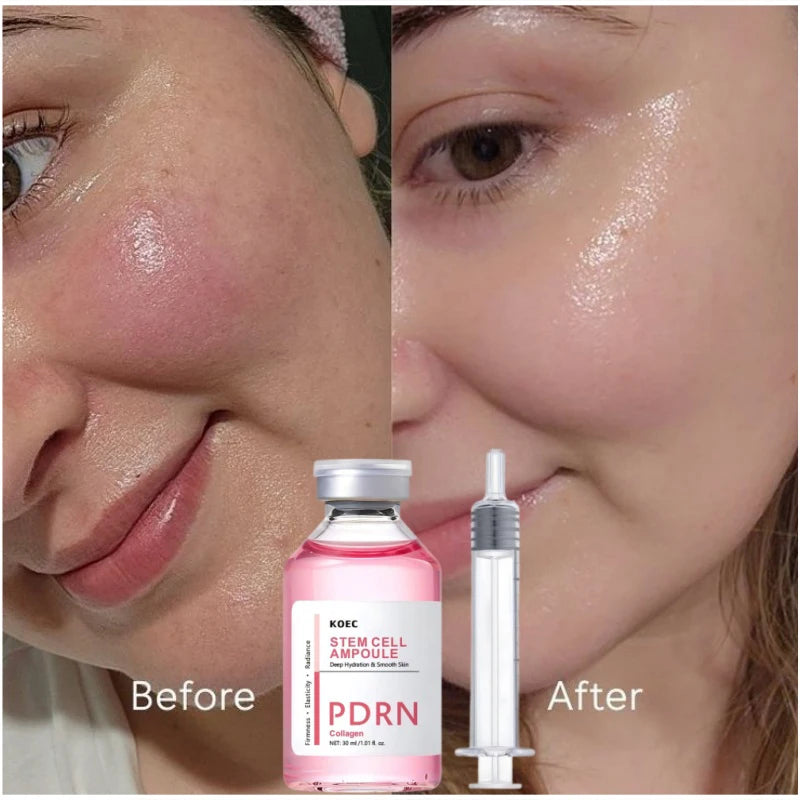 Pdrn Salmon Moisturizing Essence Collagen Blue Copper Peptide Deeply Moisturize Improve Dry Dull Firm Skin Korean Skincare New