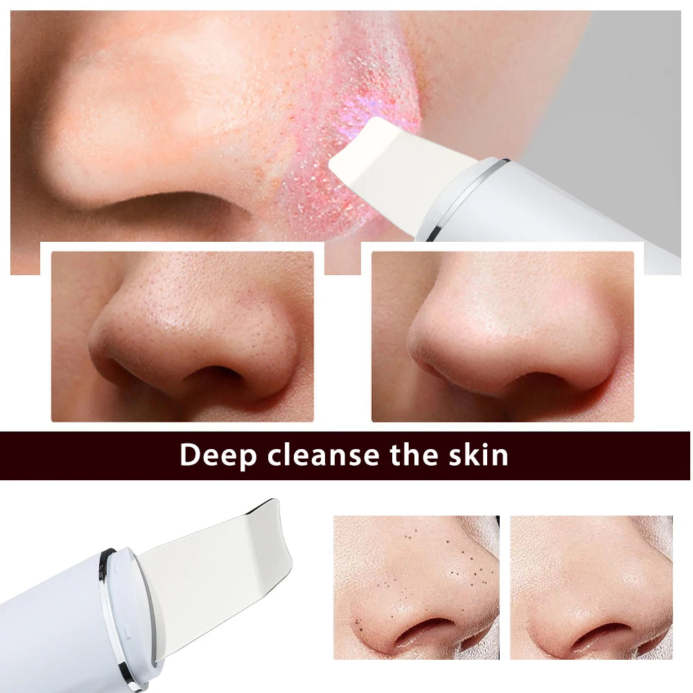 Ultrasonic Skin Scrubber EMS Face Massager Blackhead Remover Facial Cleanser Peeling Shovel Face Lifting Tool Spatula Cleansing