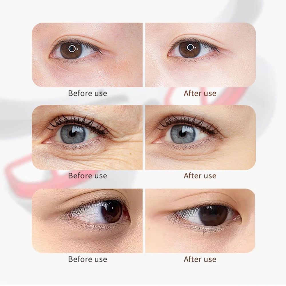 Smart Eye Massager 3D Red Light Eye Fatigue Dark Circles Relaxing Under-Eye Glasses Massage Beauty Machine