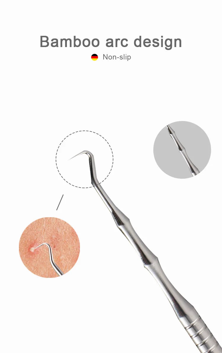 New Acne Needle Kit, Remove Blackheads, Pimples & Closed Comedones
