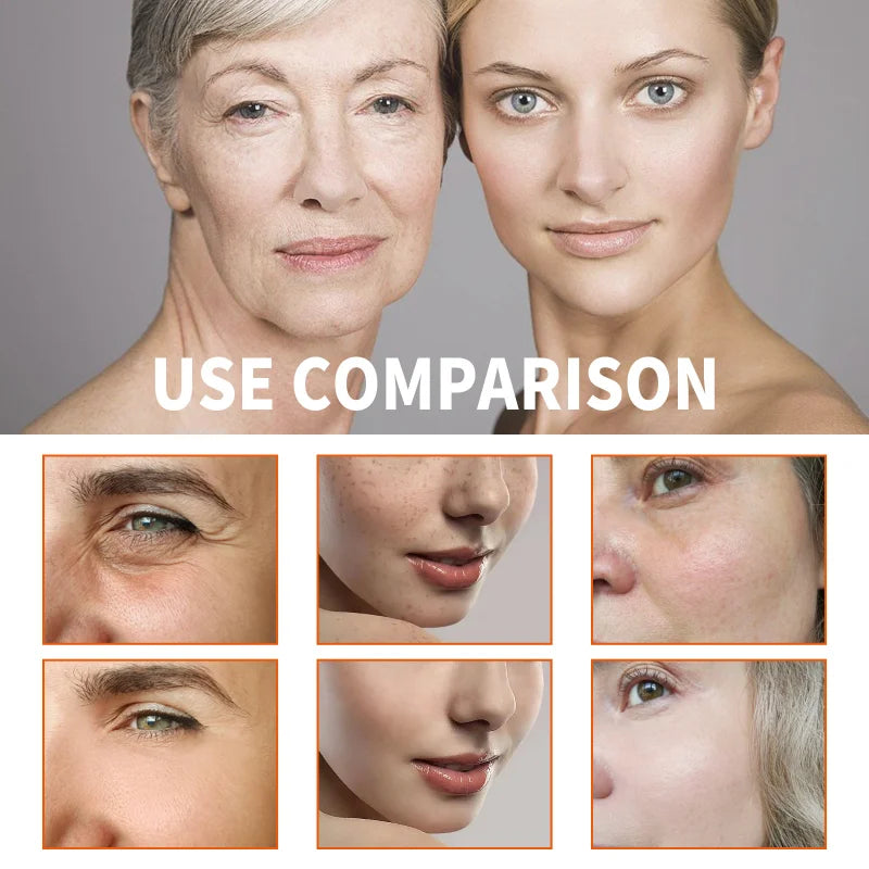 Deep Anti Wrinkle Serum Dark Spot Corrector for Face Fade Fine Lines Lifting Firming Whitening Collagen Boost Anti Aging Serum